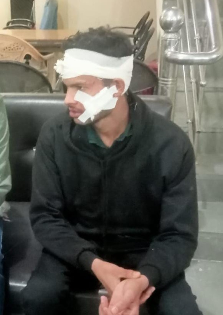 शहर में बैखोफ बदमाश-स्टेशन रोड थाने से कुछ दूरी पर ही पुलिस कांस्टेबल की परीक्षा देने जा रहे युवक और उसके दोस्त पर चाकू से हमला, शराब पीने के लिए रुपए और मोबाइल मांगे,नहीं देने पर चाकू मारे,घटना के 16 घंटे बाद FIR…